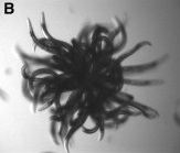 Shub-Niggurath … I mean, a collection of nematodes in a 'worm-star' formation. (Credit: Current Biology)