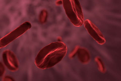 Sepsis