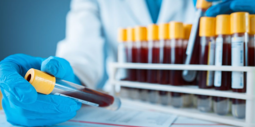biomarkers for Long Covid